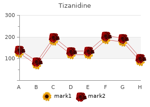 tizanidine 2 mg otc