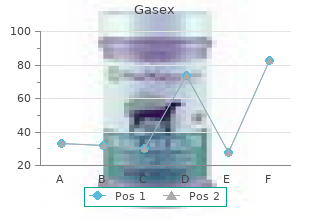 generic 100caps gasex mastercard