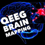 QEEG Brain Mapping